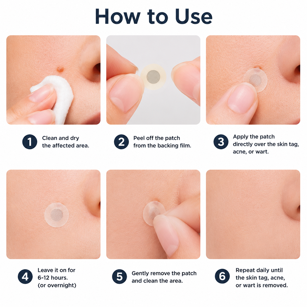 2版✨Hiskin ® 2-in-1 Microneedle & Hydrocolloid Patch🍀 | Removes raised moles, acne, flat warts, and skin tags | Helps improve wrinkles, scars, and blemishes | Invisible patches for face and body
