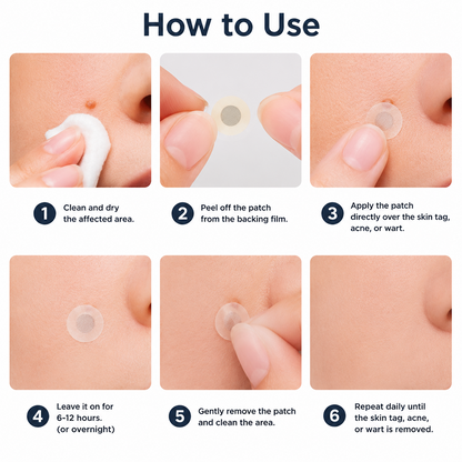 2版✨Hiskin ® 2-in-1 Microneedle & Hydrocolloid Patch🍀 | Removes raised moles, acne, flat warts, and skin tags | Helps improve wrinkles, scars, and blemishes | Invisible patches for face and body