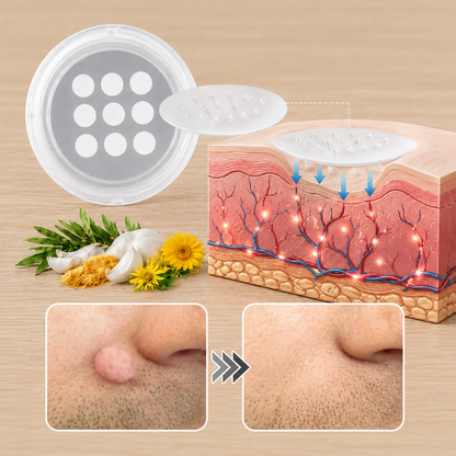 2版✨Hiskin ® 2-in-1 Microneedle & Hydrocolloid Patch🍀 | Removes raised moles, acne, flat warts, and skin tags | Helps improve wrinkles, scars, and blemishes | Invisible patches for face and body